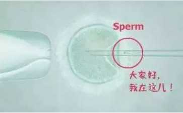 孕前染色体检查一般要多长时间才能出结果？