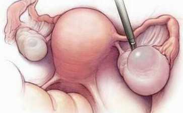 苏州三代试管婴儿医院排名一览-供卵包男孩价格